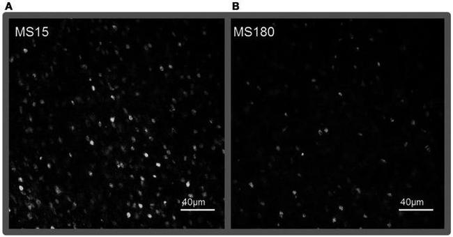 MECP2 Antibody in Immunohistochemistry (IHC)