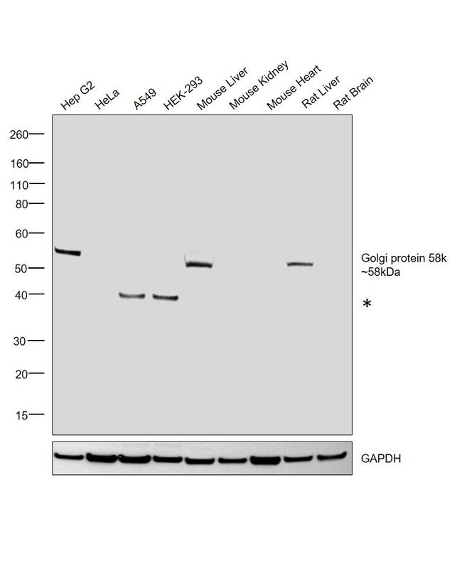 Golgi protein 58k Antibody in Western Blot (WB)