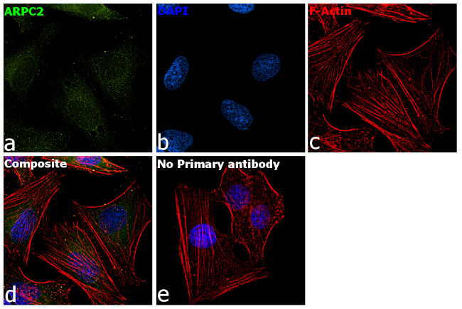 ARPC2 Antibody in Immunocytochemistry (ICC/IF)