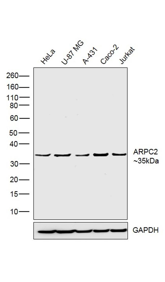 ARPC2 Antibody in Western Blot (WB)