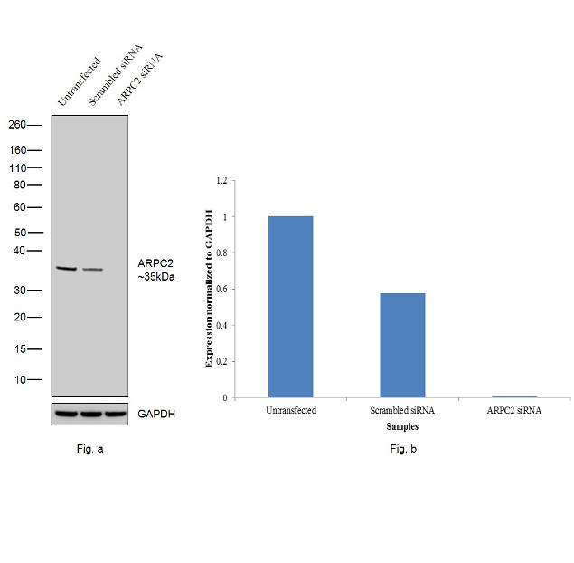 ARPC2 Antibody