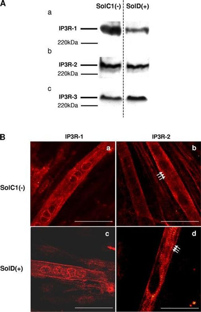 IP3 Receptor 1 Antibody in Western Blot, Immunohistochemistry (WB, IHC)