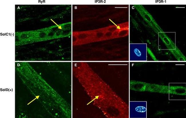 IP3 Receptor 1 Antibody in Immunohistochemistry (IHC)