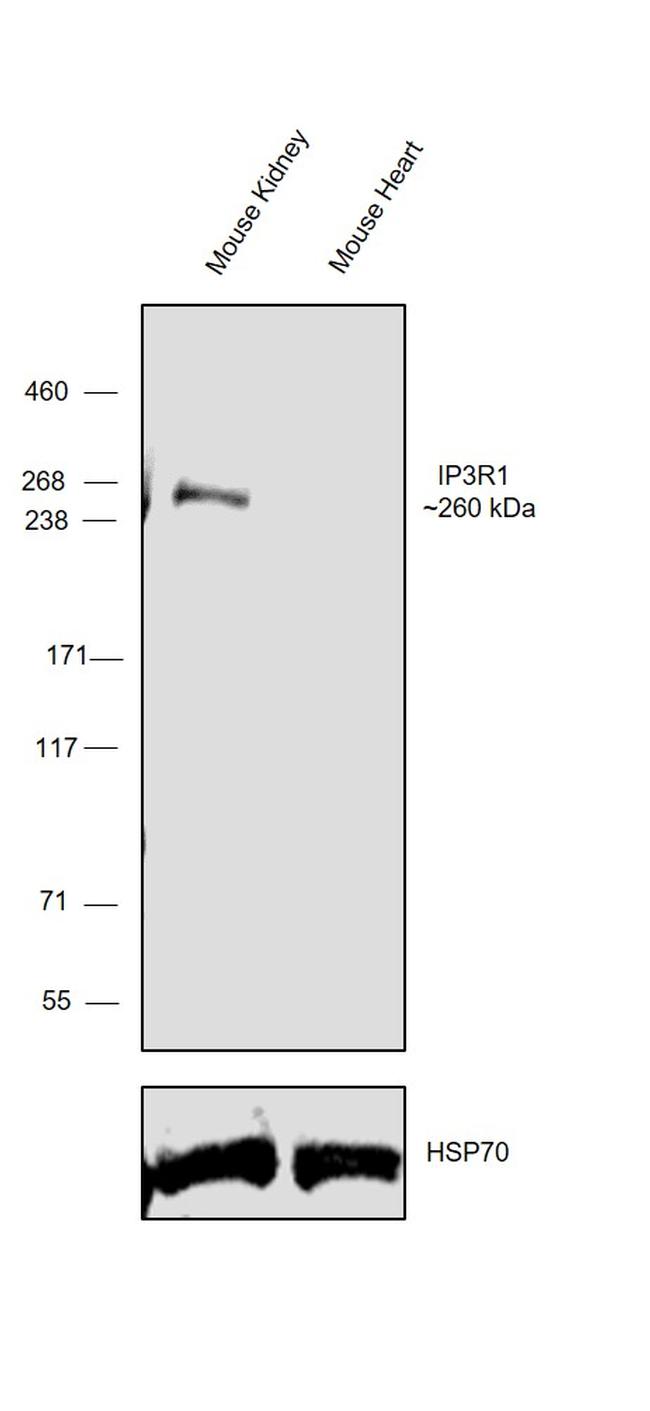 IP3 Receptor 1 Antibody in Western Blot (WB)