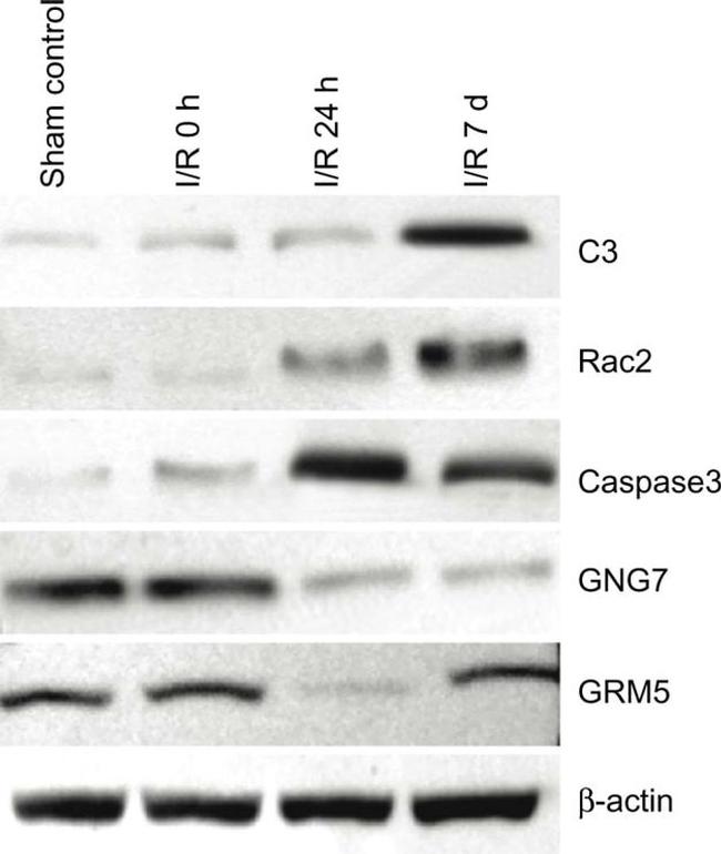 RAC2 Antibody in Western Blot (WB)