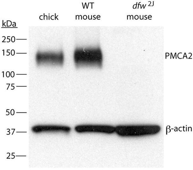 PMCA2 ATPase Antibody in Western Blot (WB)