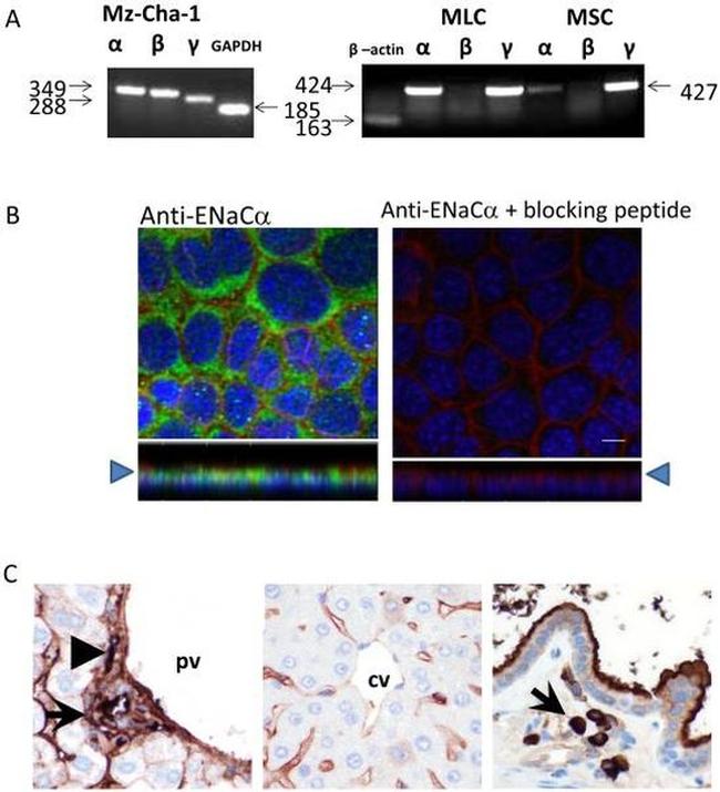 alpha-ENaC Antibody in Immunohistochemistry (Paraffin) (IHC (P))