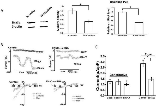 alpha-ENaC Antibody in Western Blot (WB)