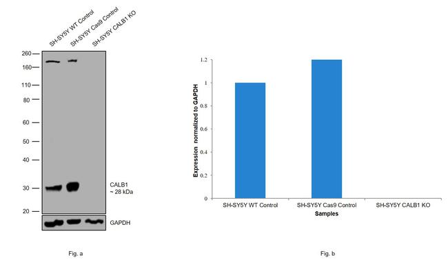 Calbindin D28K Antibody in Western Blot (WB)