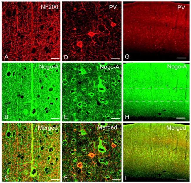 Parvalbumin Antibody in Immunohistochemistry (IHC)