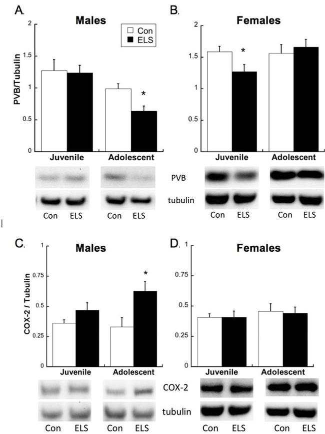 Parvalbumin Antibody in Western Blot (WB)