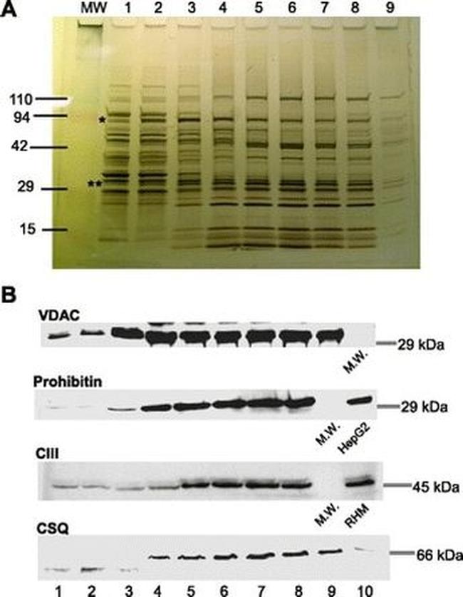 VDAC Antibody in Western Blot (WB)