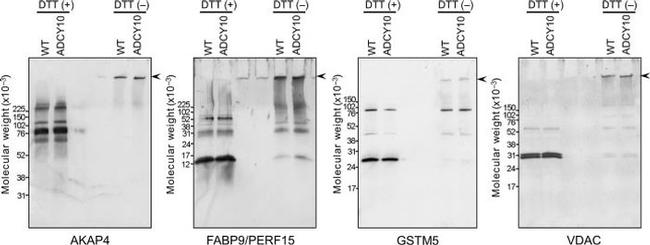 VDAC Antibody in Western Blot (WB)