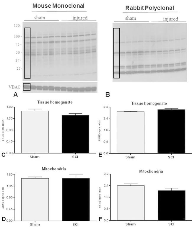 VDAC Antibody in Western Blot (WB)