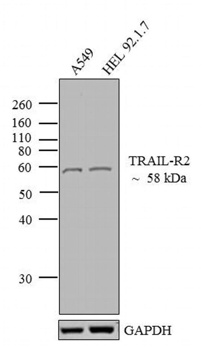 TRAIL-R2 (DR5) Antibody in Western Blot (WB)