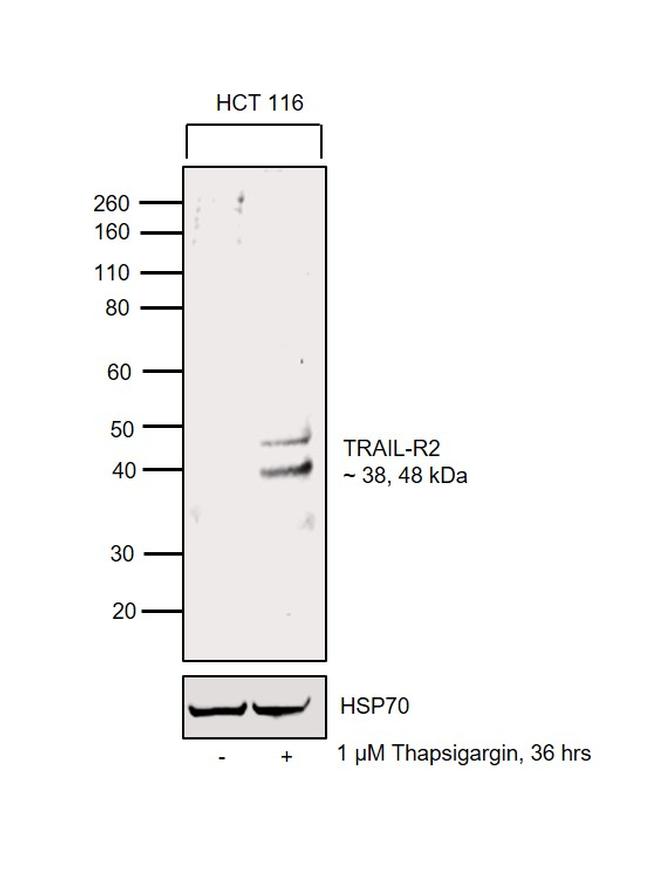 TRAIL-R2 (DR5) Antibody