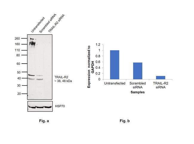 TRAIL-R2 (DR5) Antibody in Western Blot (WB)