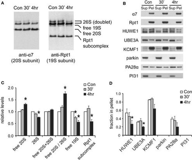 PSME1 Antibody in Western Blot (WB)