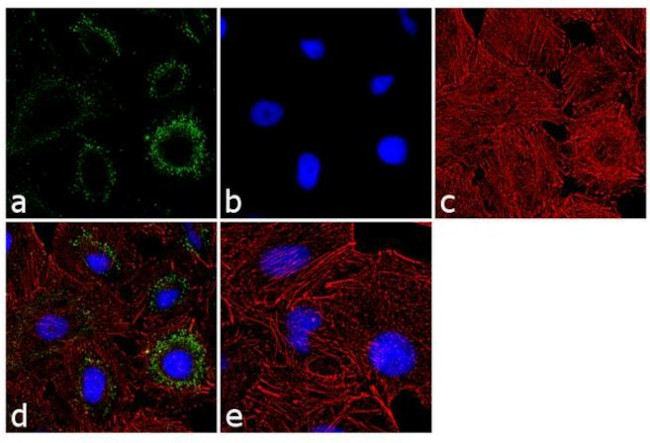 PSMA1 Antibody in Immunocytochemistry (ICC/IF)