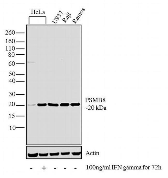 PSMB8 Antibody in Western Blot (WB)