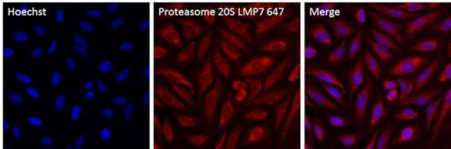 PSMB8 Antibody in Immunocytochemistry (ICC/IF)