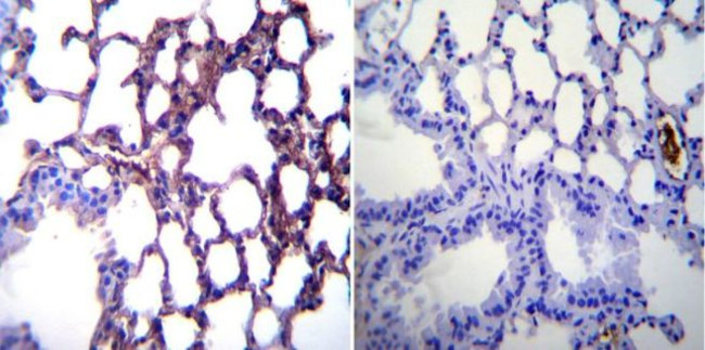 iNOS Antibody in Immunohistochemistry (Paraffin) (IHC (P))