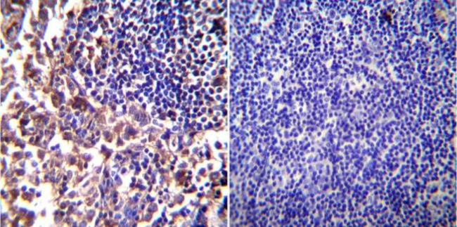 iNOS Antibody in Immunohistochemistry (Paraffin) (IHC (P))