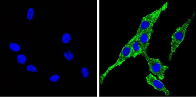 Cyp4a10 Antibody in Immunocytochemistry (ICC/IF)