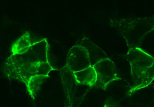 Endothelin A Receptor Antibody in Immunocytochemistry (ICC/IF)