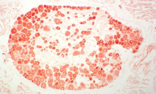 Endothelin 1 Antibody in Immunohistochemistry (IHC)