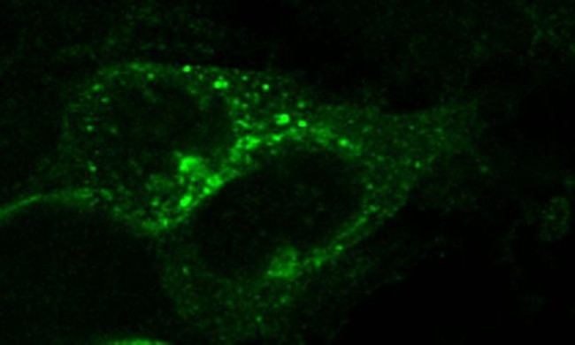 CXCR7 Antibody in Immunocytochemistry (ICC/IF)