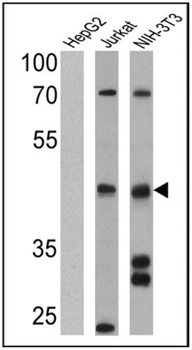 SSTR4 Antibody in Western Blot (WB)
