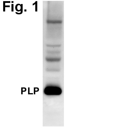 PLP1 Antibody in Western Blot (WB)