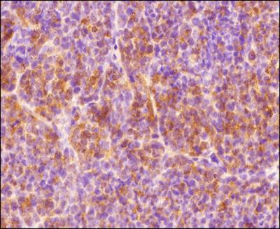 HIF1A Antibody in Immunohistochemistry (Paraffin) (IHC (P))