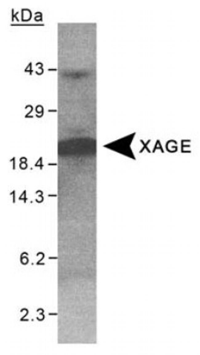 XAGE1 Antibody in Western Blot (WB)