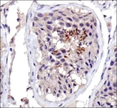 DNMT3A Antibody in Immunohistochemistry (Paraffin) (IHC (P))