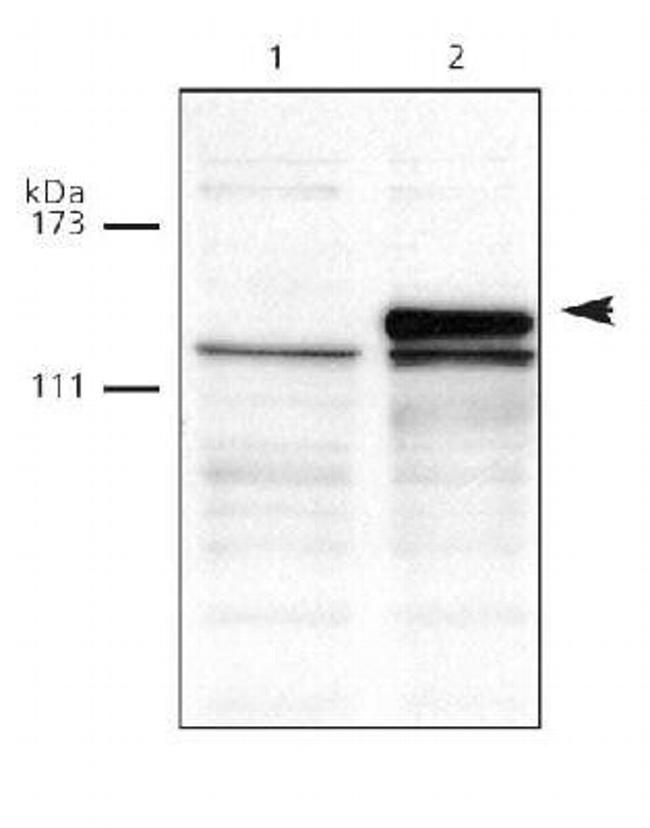 DNMT3A Antibody in Western Blot (WB)