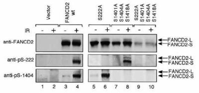 Phospho-FANCD2 (Ser222) Antibody in Western Blot (WB)