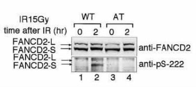 Phospho-FANCD2 (Ser222) Antibody in Western Blot (WB)