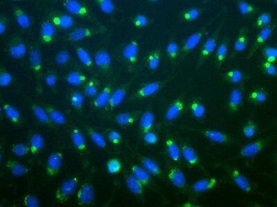 Ubiquitin Antibody in Immunocytochemistry (ICC/IF)