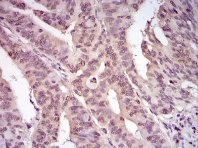 Ubiquitin Antibody in Immunohistochemistry (Paraffin) (IHC (P))