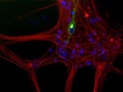 NEFL Antibody in Immunocytochemistry (ICC/IF)