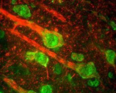 NEFM Antibody in Immunohistochemistry (Frozen) (IHC (F))