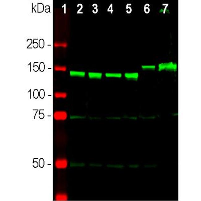 NEFM Antibody in Western Blot (WB)