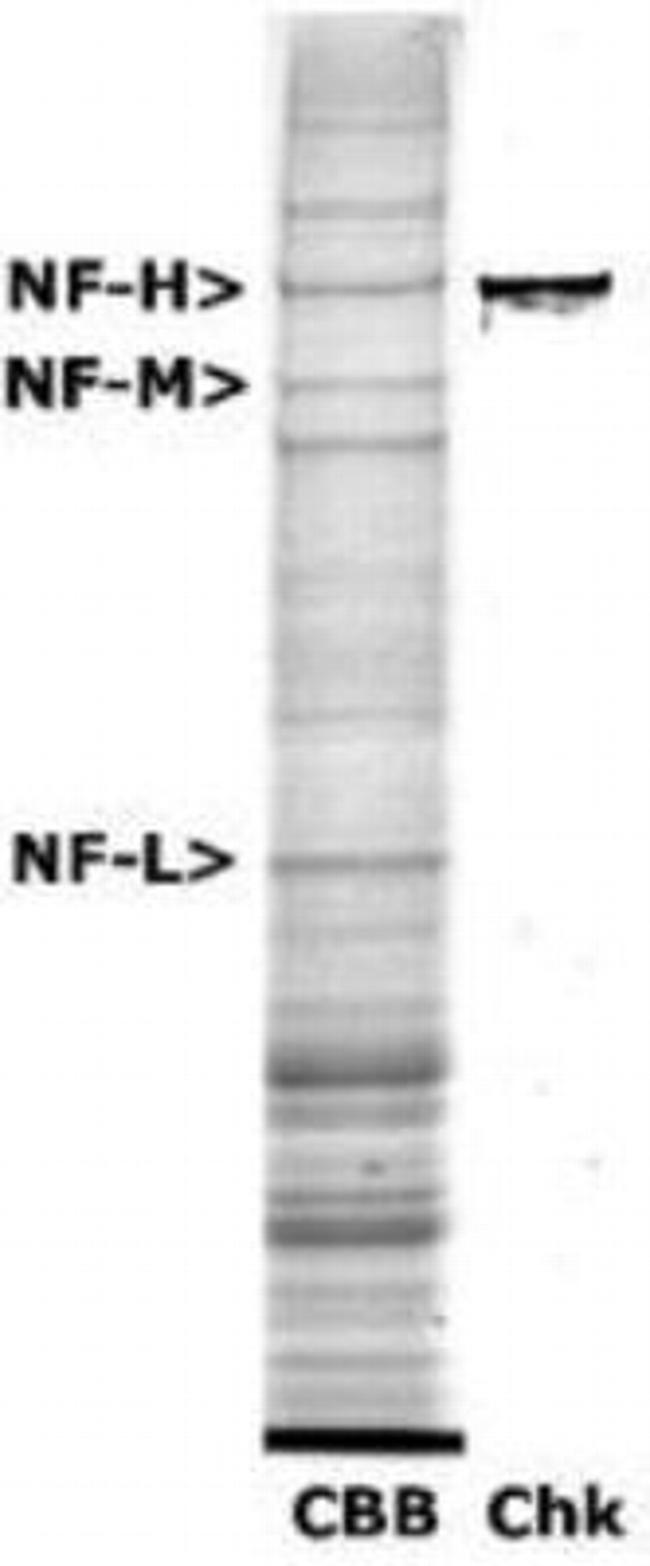 NF-H Antibody in Western Blot (WB)