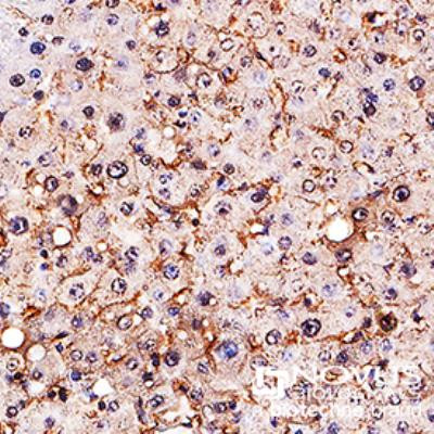 SR-BI Antibody in Immunohistochemistry (Paraffin) (IHC (P))