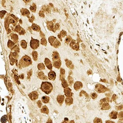 PLTP Antibody in Immunohistochemistry (Paraffin) (IHC (P))