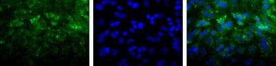 LIMP2 Antibody in Immunocytochemistry (ICC/IF)