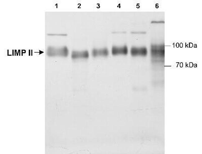 LIMP2 Antibody in Western Blot (WB)