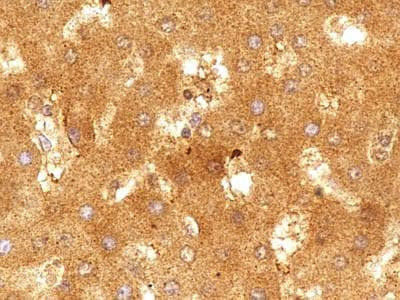 SR-BI/SR-BII Antibody in Immunohistochemistry (Paraffin) (IHC (P))